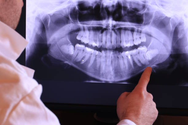 Best After-Hours Dental Trauma Care in Covedale, OH