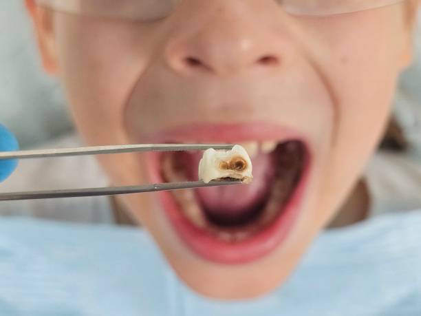 Best Cosmetic Emergency Dentistry in Covedale, OH